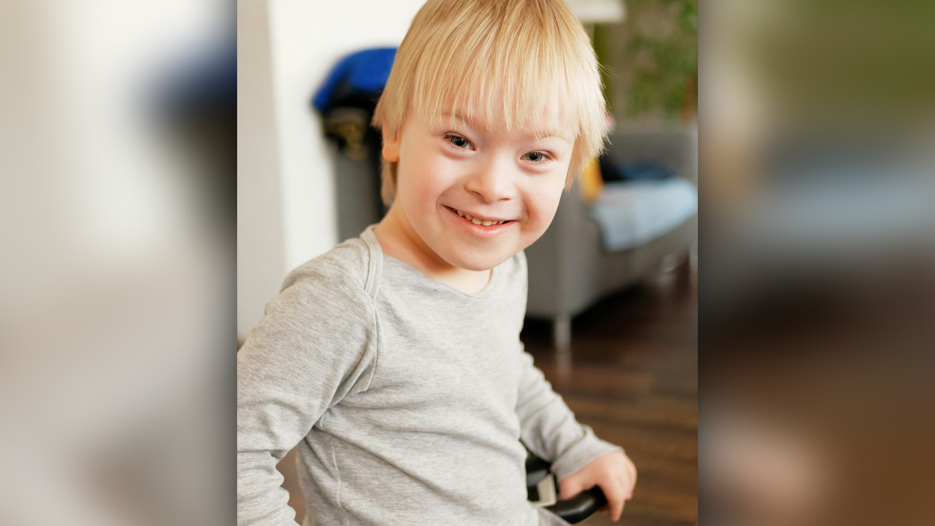 Trisomy 21 (Down syndrome)